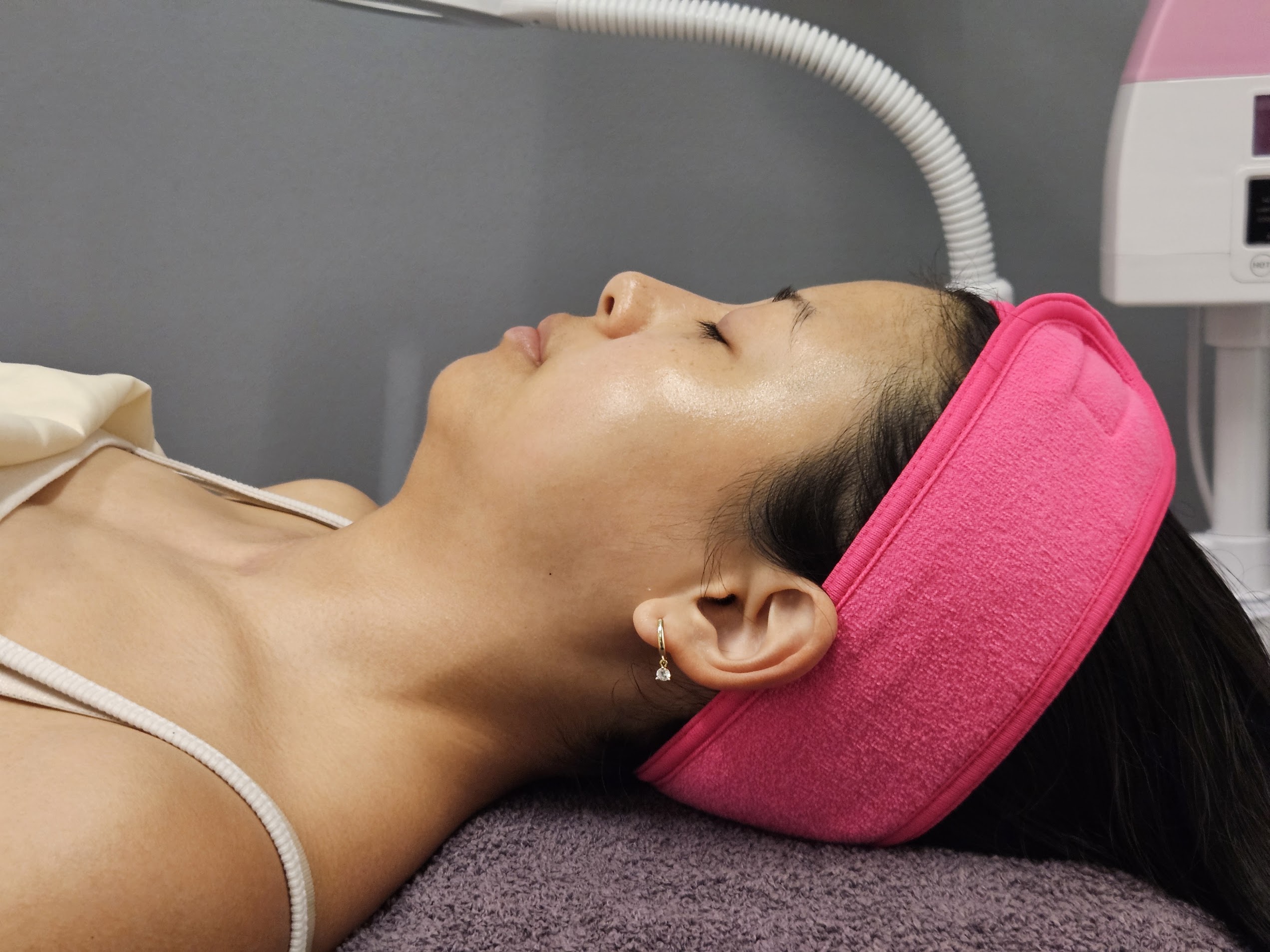 After treatment at Ageless Skin Studio