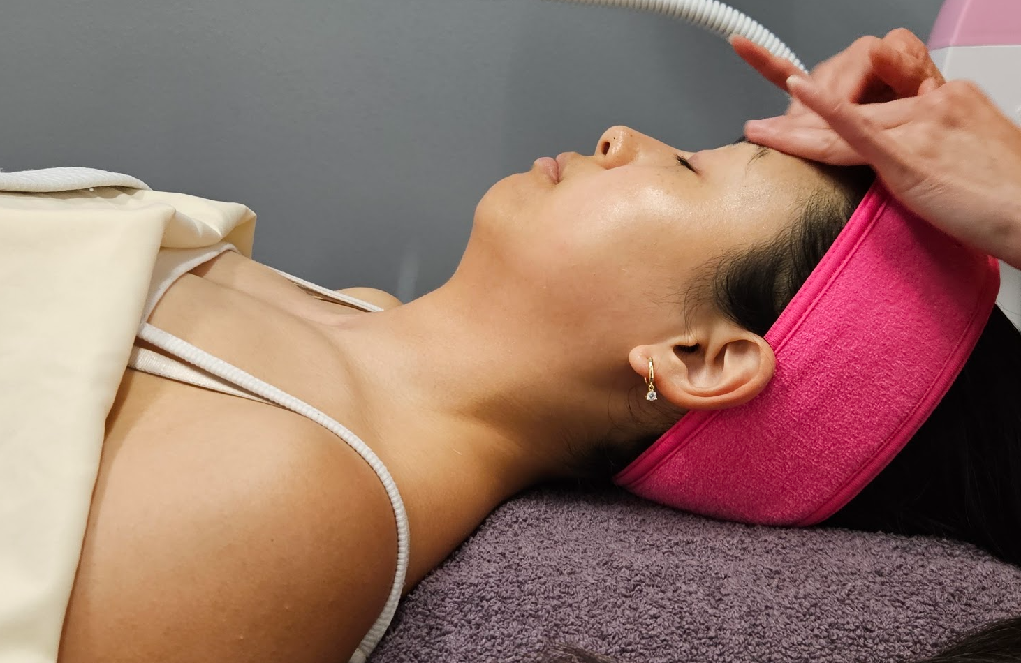 Before treatment at Ageless Skin Studio